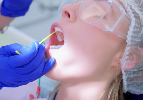 Dentist make fluoridation of teeth after ultrasonic cleaning for young woman. Stomatologist apply fluoride on patient's teeth. Portrait of young woman. Stomatology clinic, cure, treatment, procedure.